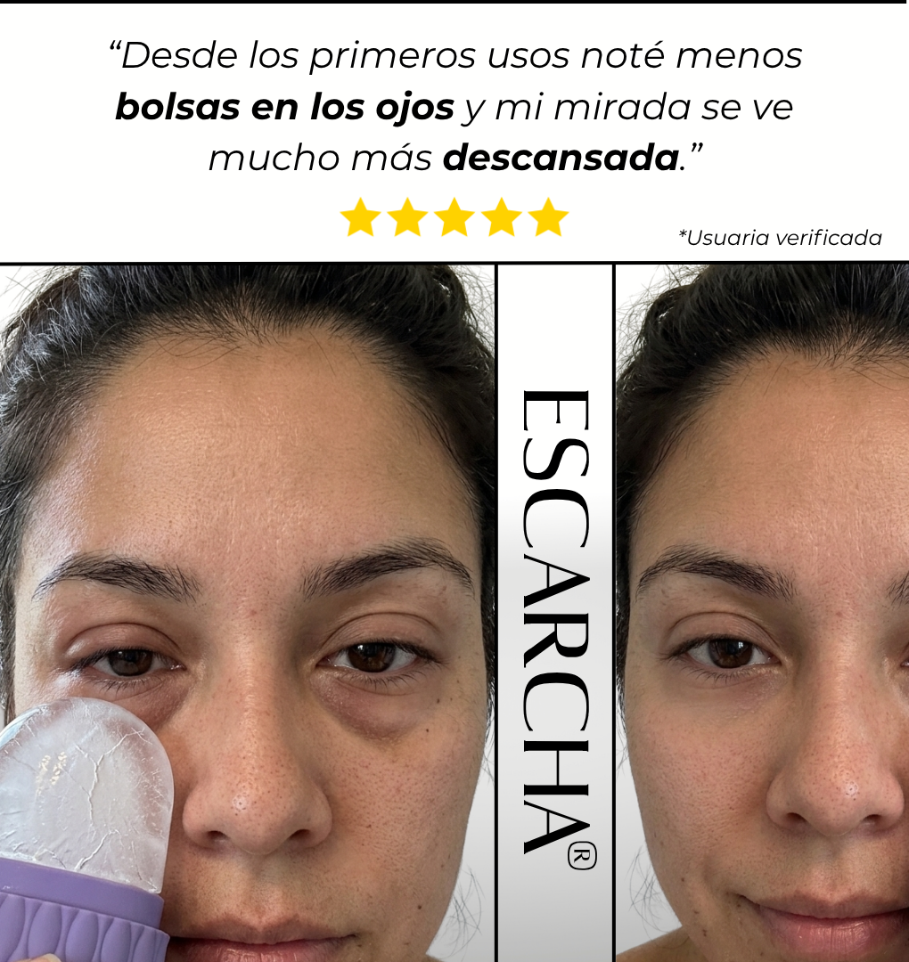 Kit Escarcha®: Calmante Facial + Guía de Crioterapia Botánica
